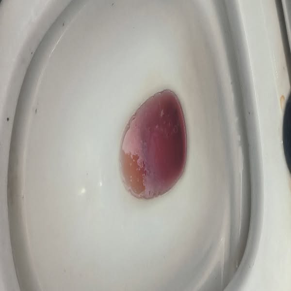 Good News for Every Woman with Recurring UTIs