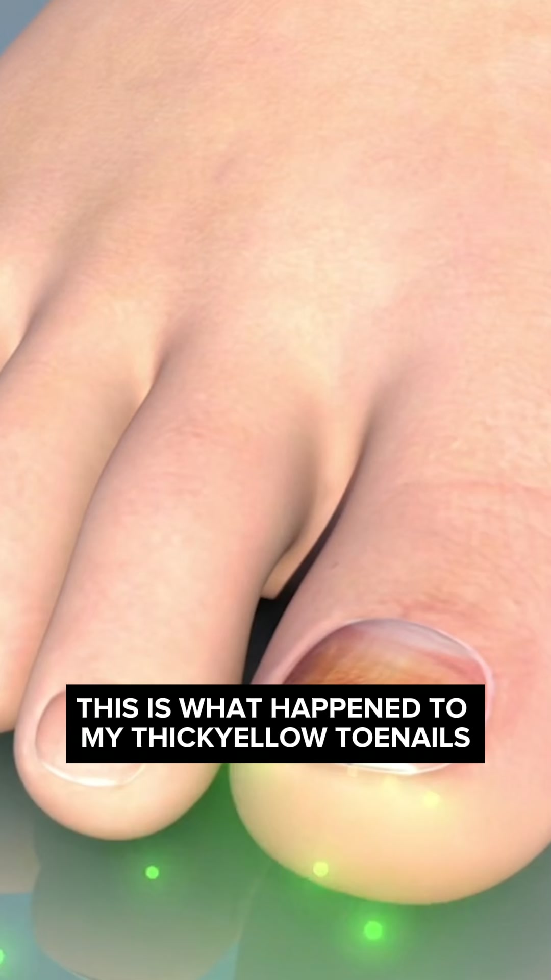 Orgatics makes your toenails look healthy again
