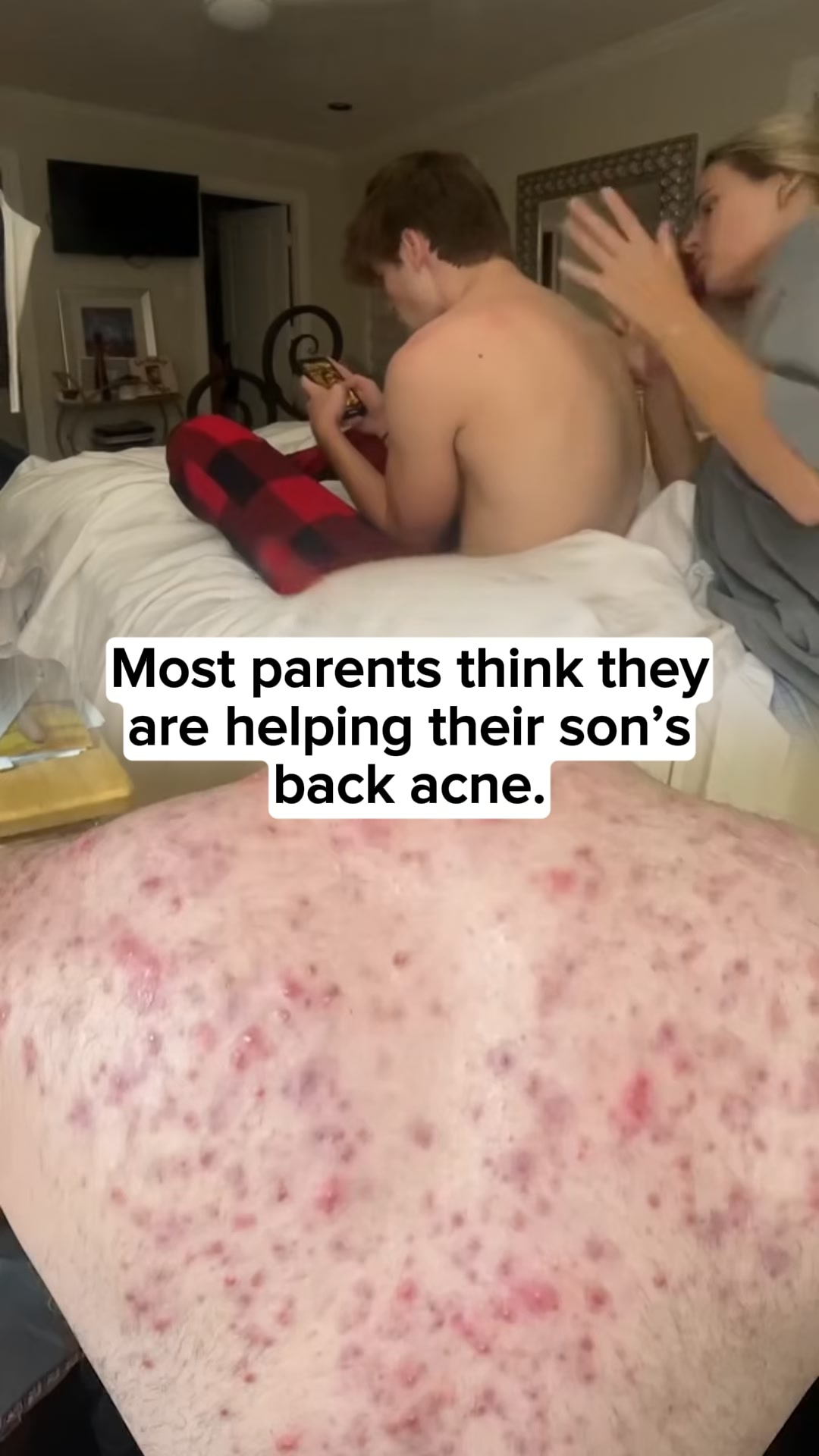 Built for Body and Back Skin.