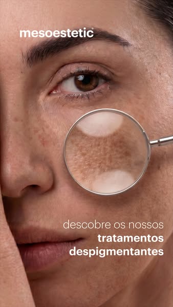 Prevent Dark Spots with melan 130