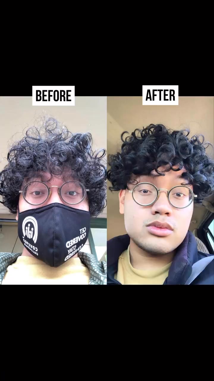 Stop the Dandruff Cycle