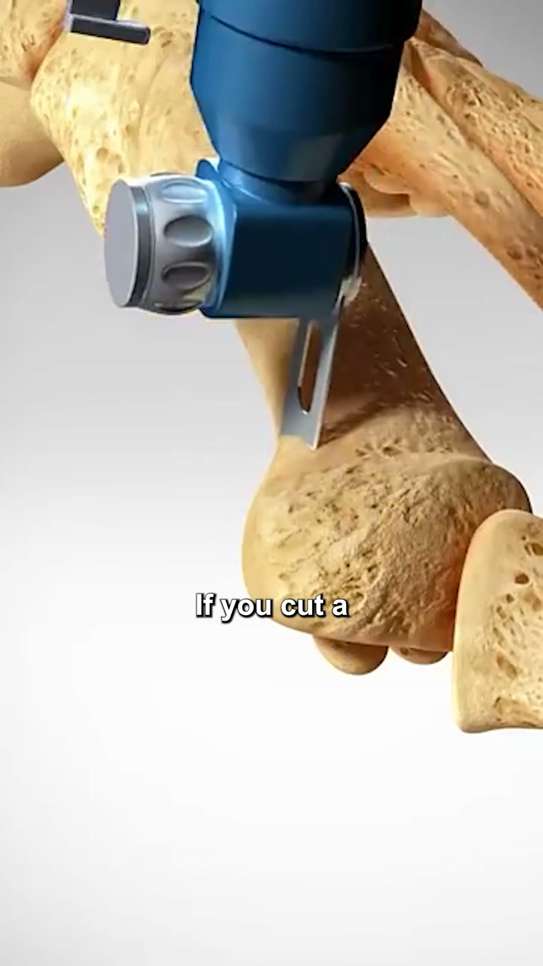 If you cut a bunion off, it grows back