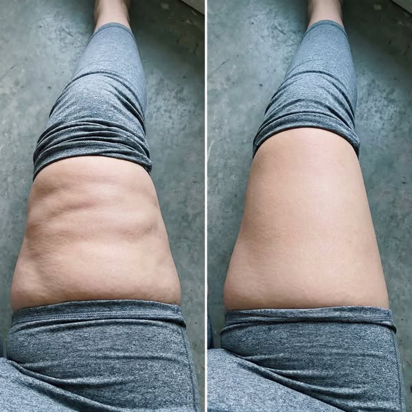 Feel Lighter Legs with Natural Lymphatic Support