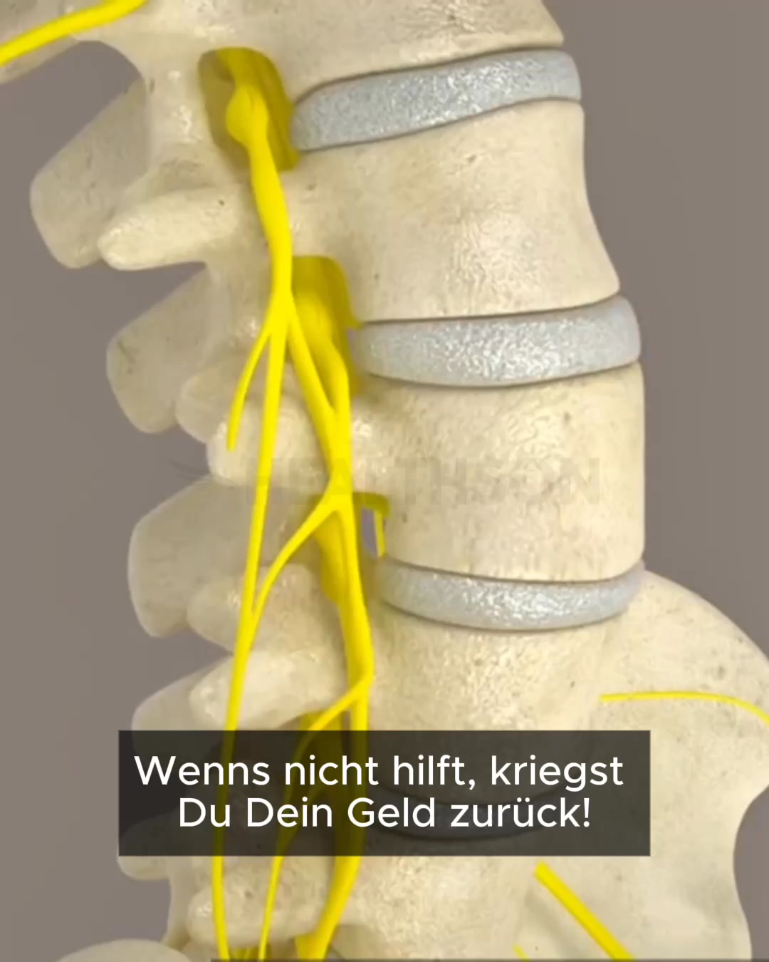 Schmerzfrei in 14 Tagen – oder Geld zurück!
