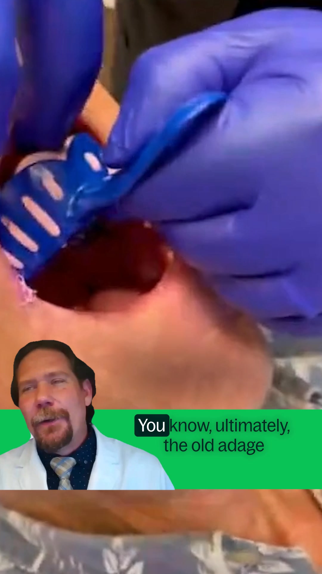 Webinar: 8 Tips for Perfect Dentures