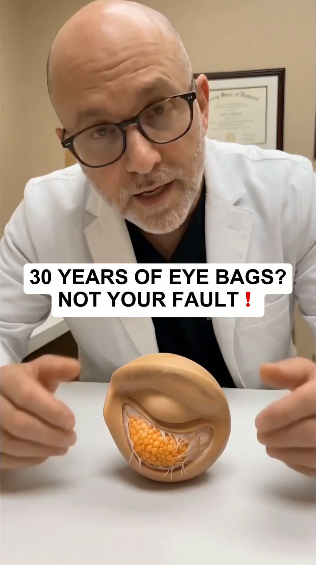 30 years of eye bags? Not your fault.