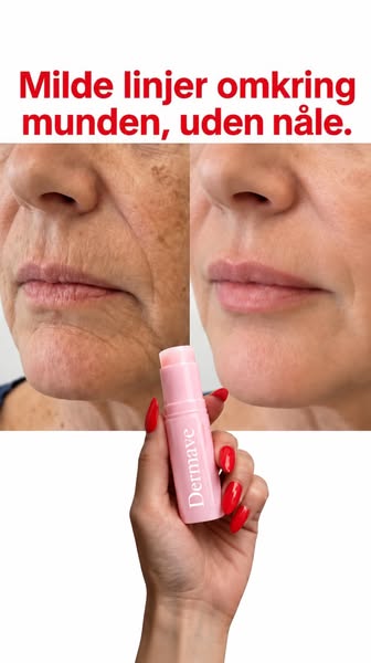 Dermave™ – Kun 249 DKK