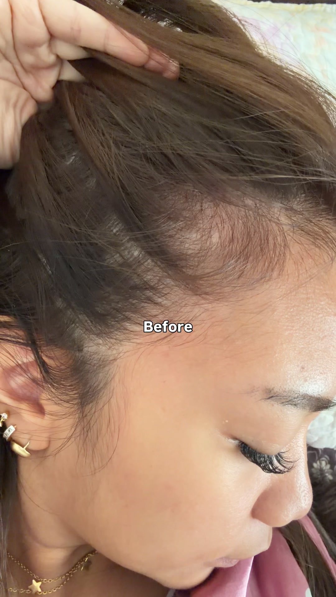 See Visible Results in Just 3 Months!