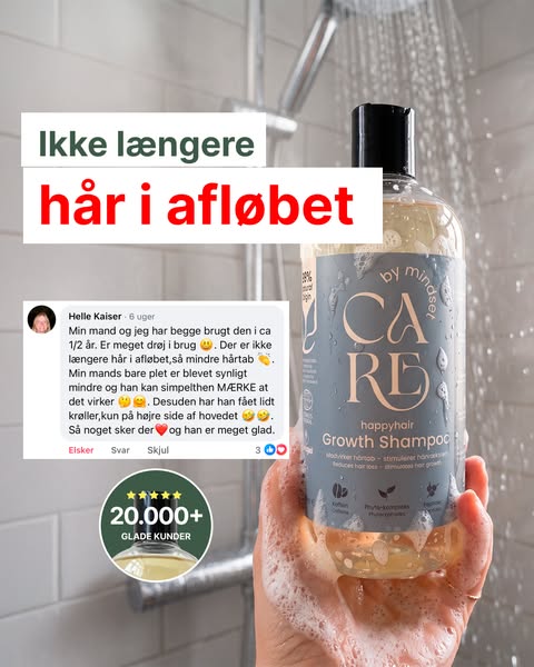 Farvel hårtab — goddag nyt hår