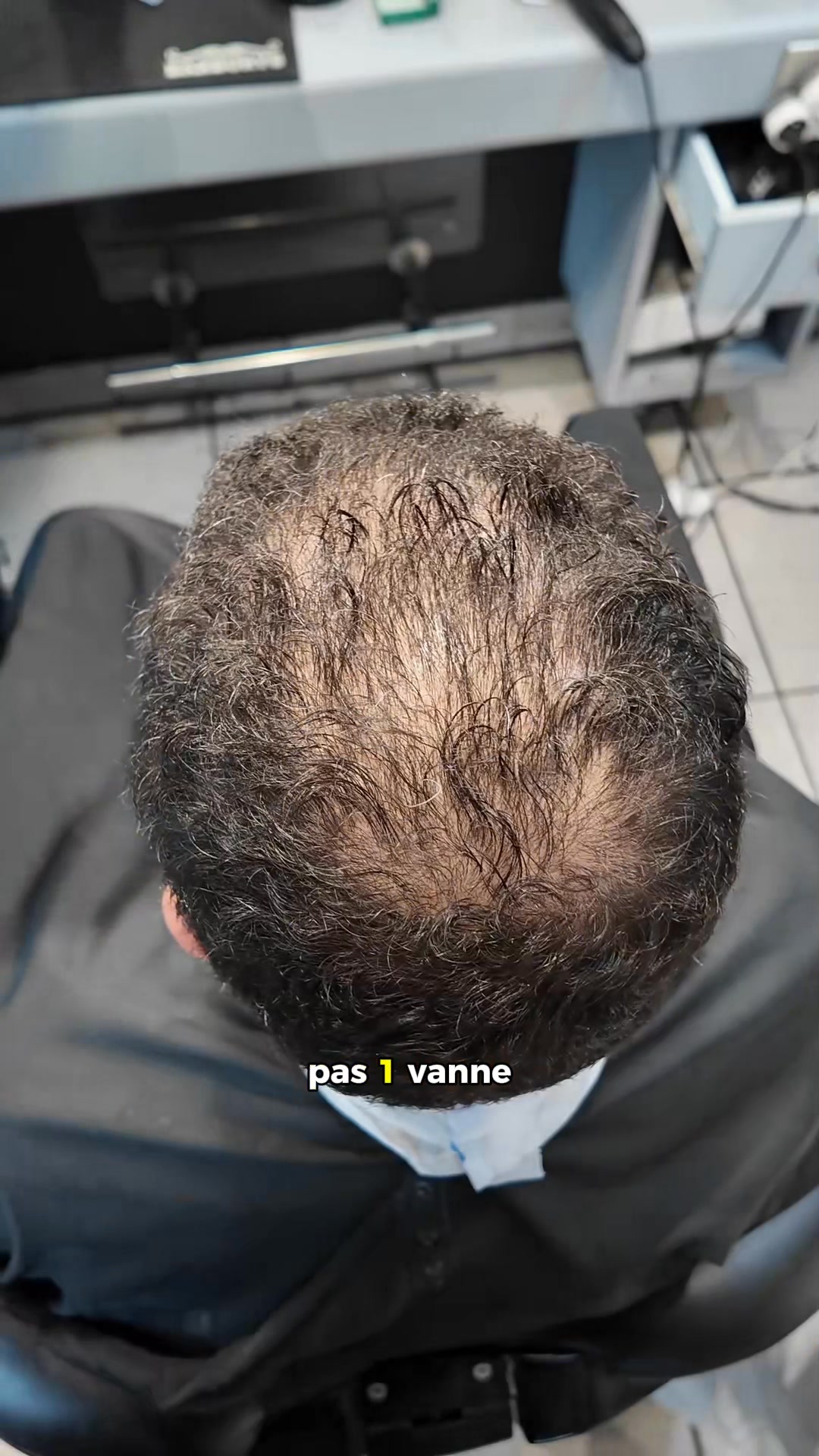 Complexe capillaire ? La solution en 30s