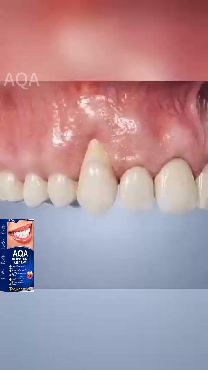 FDA-Approved Gum Regeneration at Home