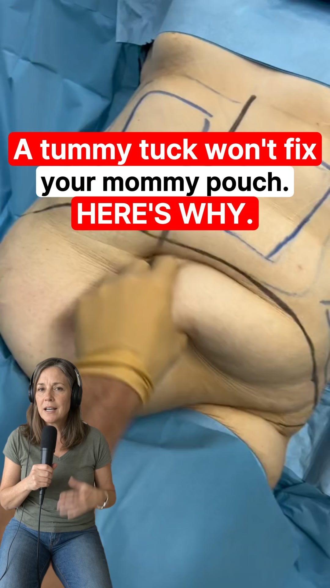 Reduce Mom pouch at home