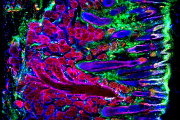 Blood, skin and brain stem cells reveal ageing mechanisms