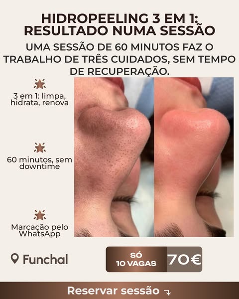Veja o que uma sessão faz pela sua pele
