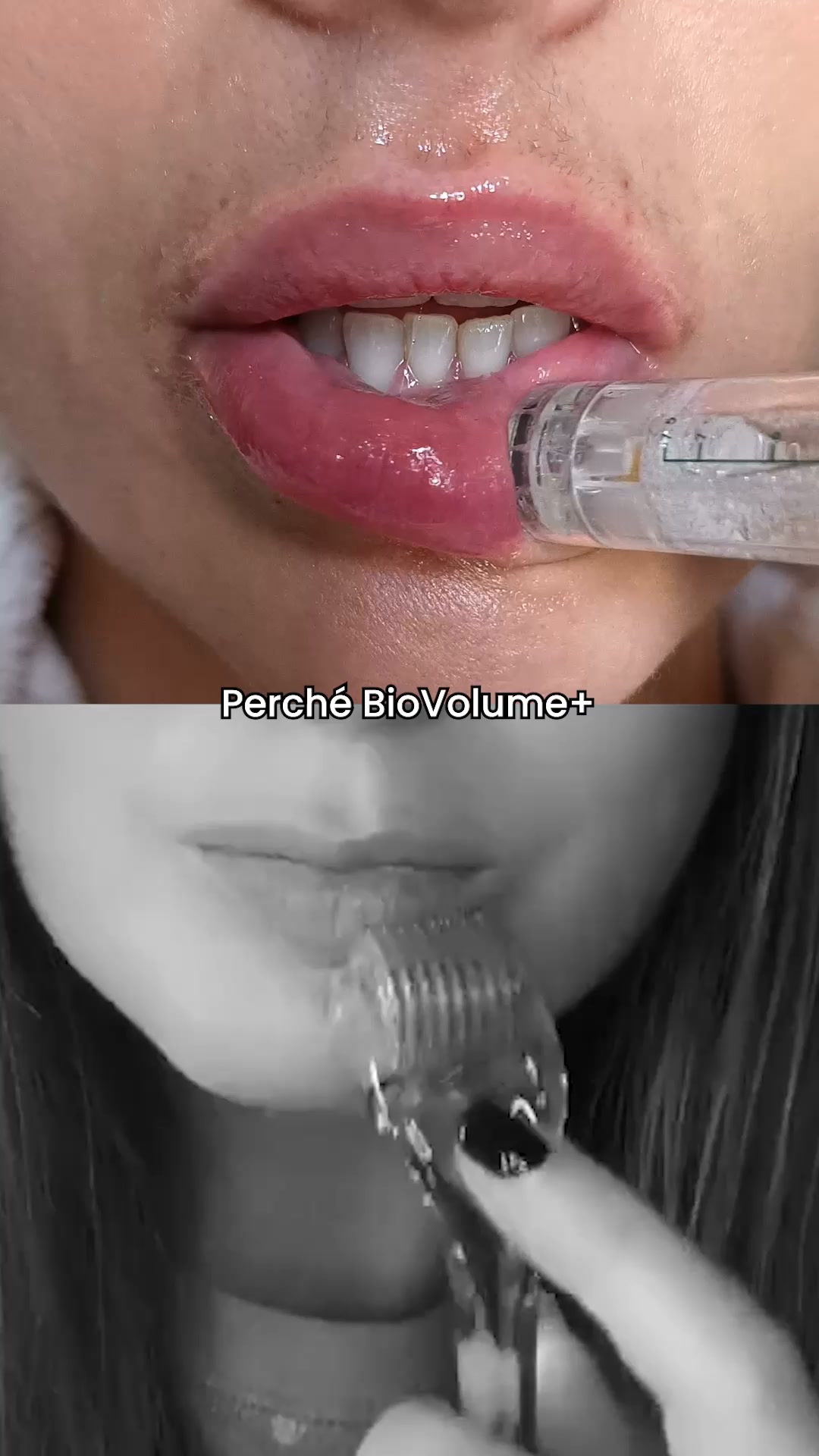 Timbro, non rullo. Ecco perché.