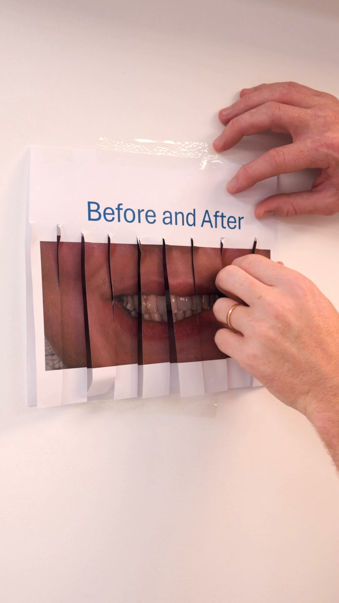 FREE Invisalign appointment fast.