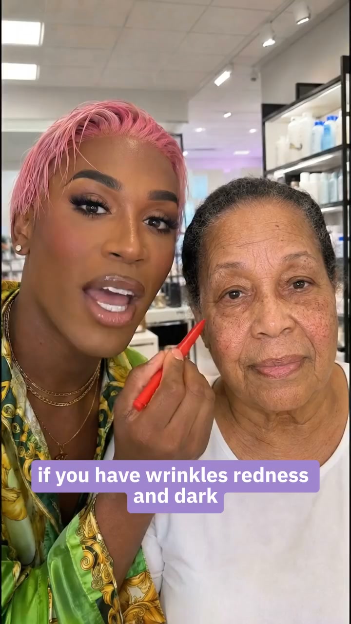 "Stop Putting Concealer On Your Dark Undereyes And Marionette Lines. I Mean It."