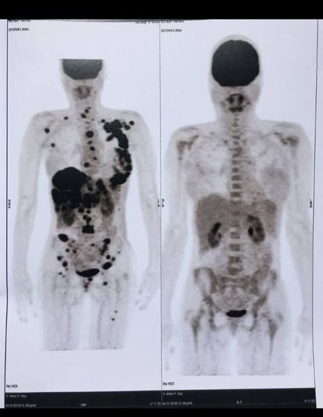 Découvrez comment Spooky2 améliore la vitalité cellulaire