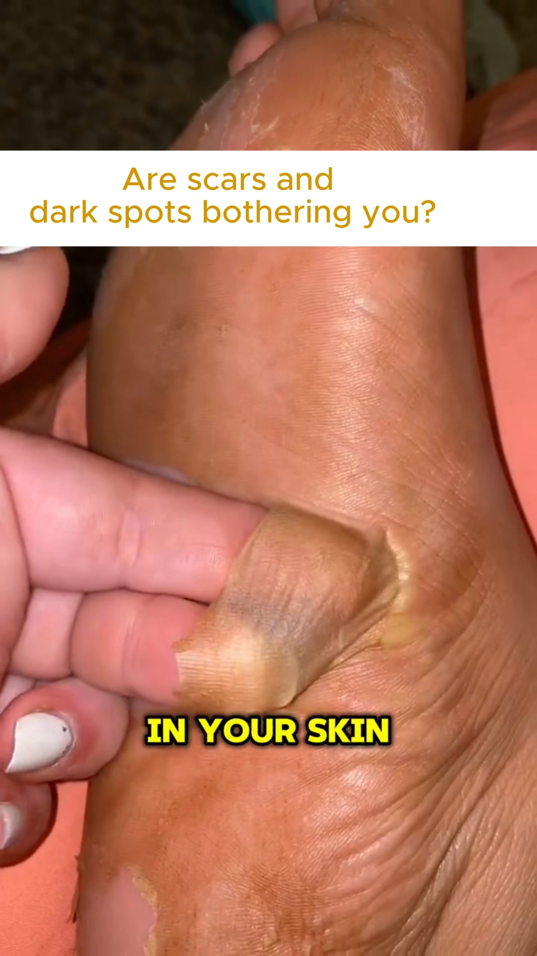 Are you tired of dealing with rough, dry and cracked skin on your hands?