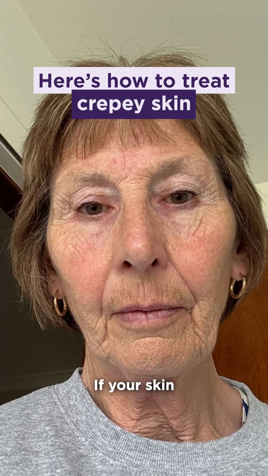 Crepey skin isn't a wrinkle problem