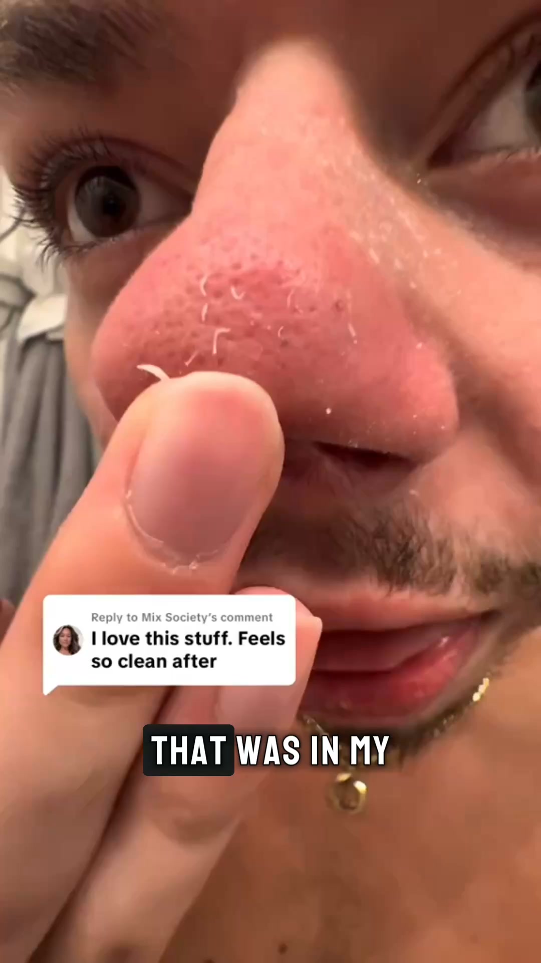Say goodbye to blackheads