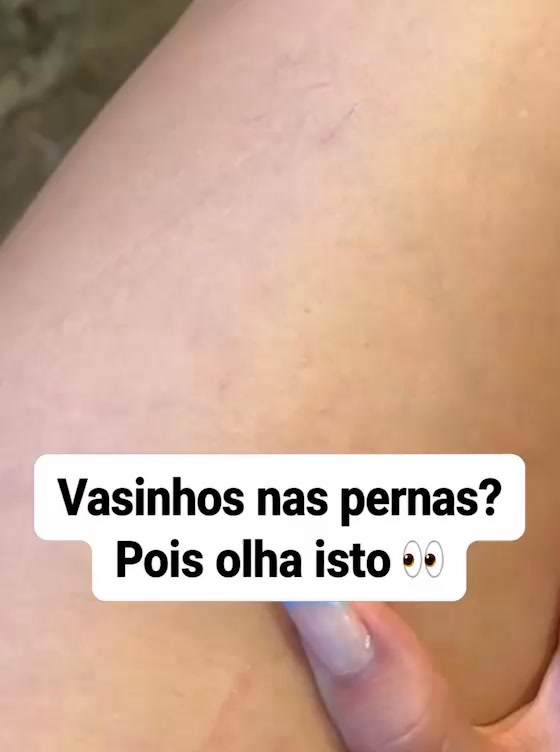 Cobrança Disponível