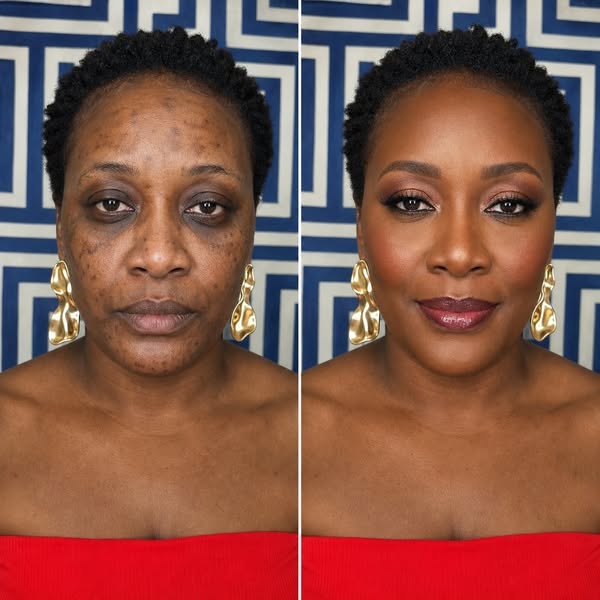 A new anti-wrinkle and dark spot serum