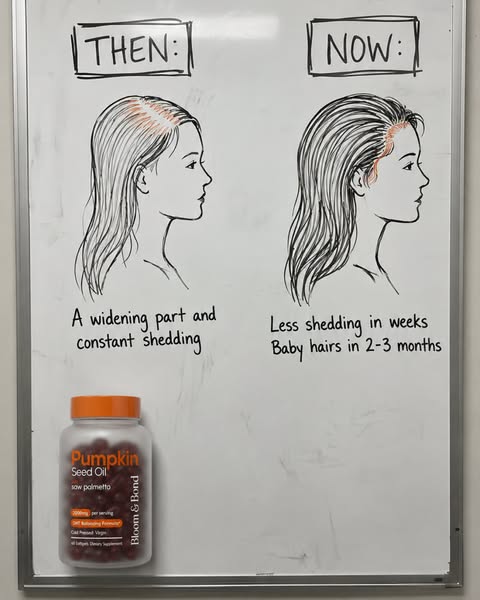 Help Hair Loss Naturally