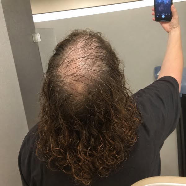 Read this if nothing you put on your scalp ever seems to work