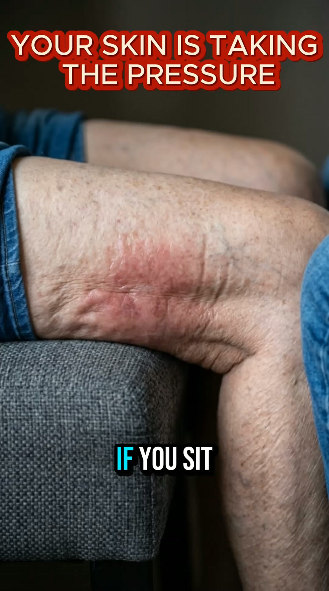 The Alum Gel Seat Cushion gives instant pressure relief so you can sit for hours without the pain.