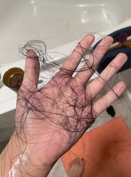 Me quedaban mechones enteros en la mano