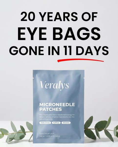 20 years of eye bags. Gone in 11 days.