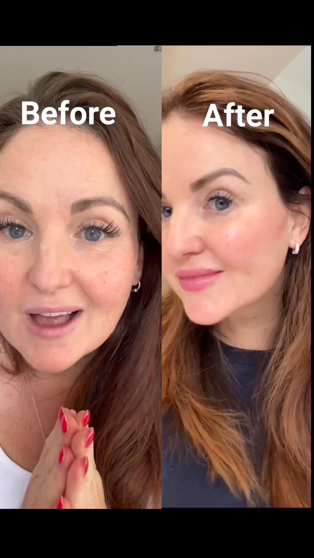The at-home treatment everyone’s switching to