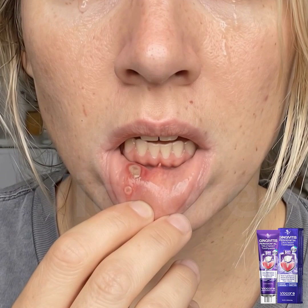 Gum Healing Endorsed by the British Dental Association (BDA) | Delivery within 2-4 working days | Full refund guarantee