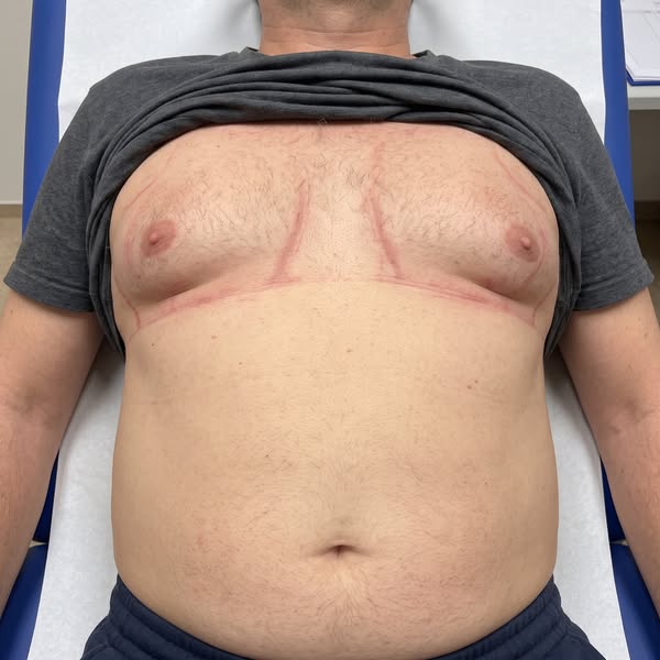Nicht dein Lifestyle ist schuld, sondern dein Lymphsystem