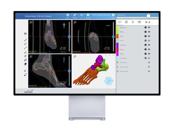 AI-Driven 3D Segmentation Tools | Spine