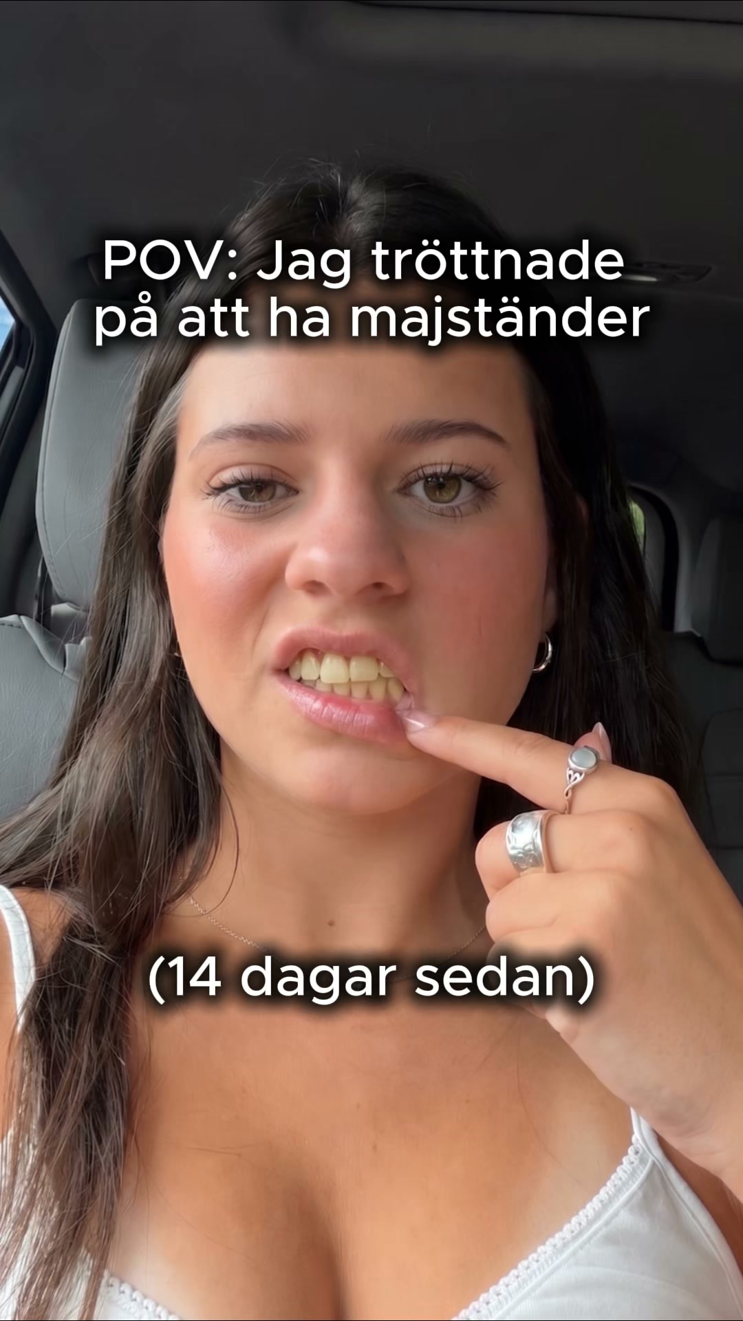 Gula toner? Bli av med dem på 30 sekunder