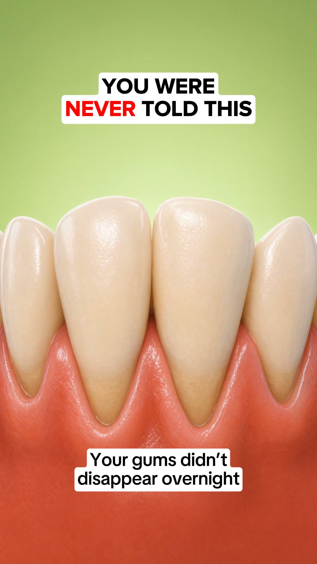 My Gums Kept Pulling Back