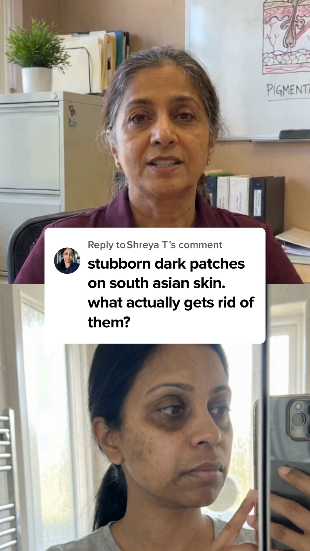 Fade Stubborn Dark Patches Finally