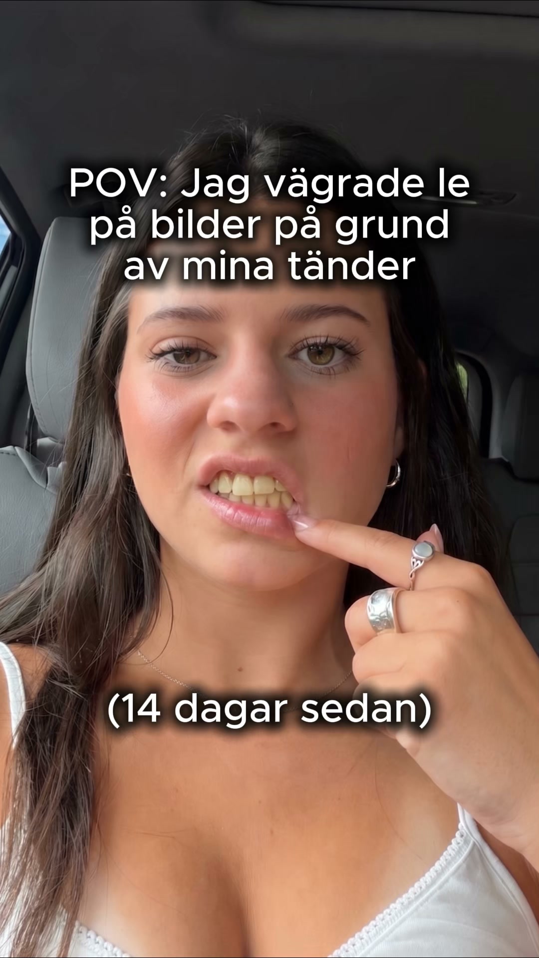 Gula toner? Bli av med dem på 30 sekunder