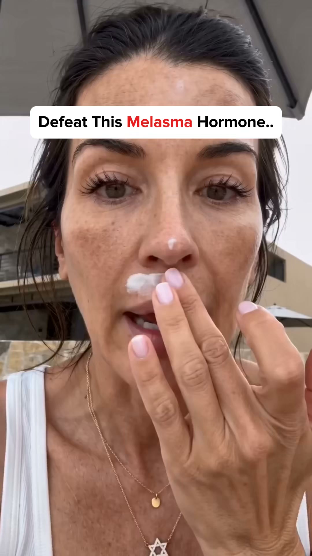 Stop Covering Melasma With Makeup, Do This Instead