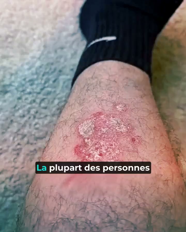 Enfin un soin qui apaise vraiment votre peau