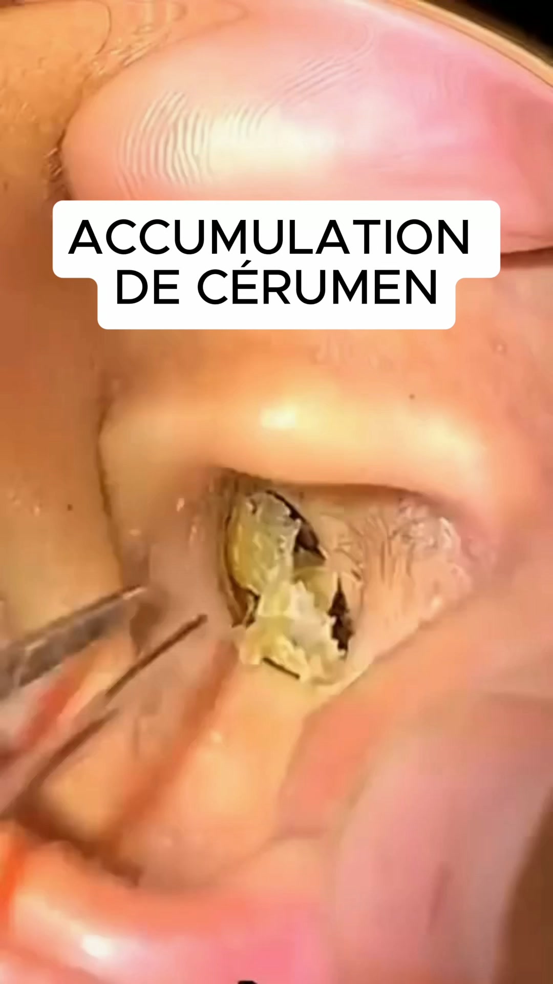 La réponse était sur la boîte