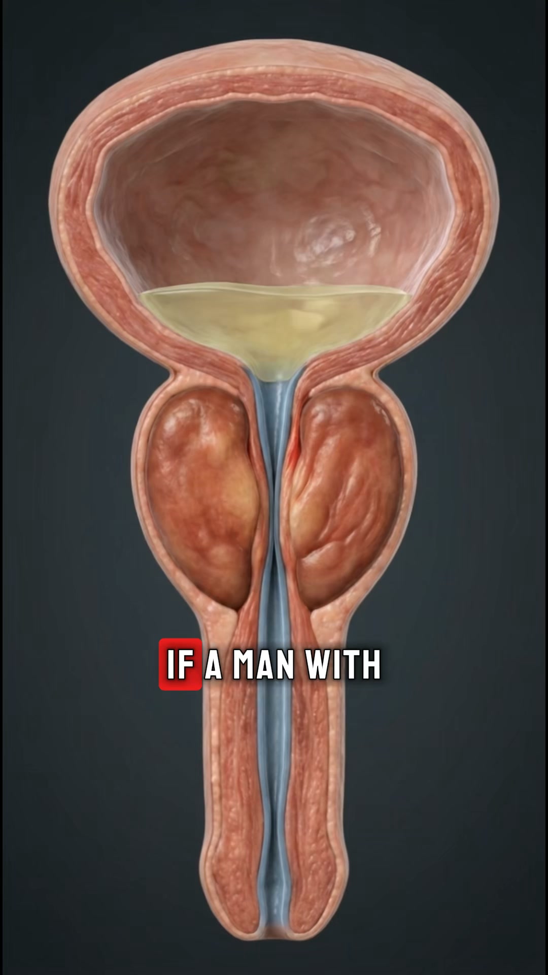 Flomax manages it. It doesn't fix it.