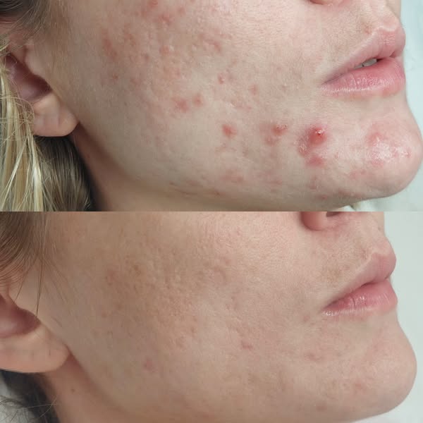 Book Your Skin Consultation