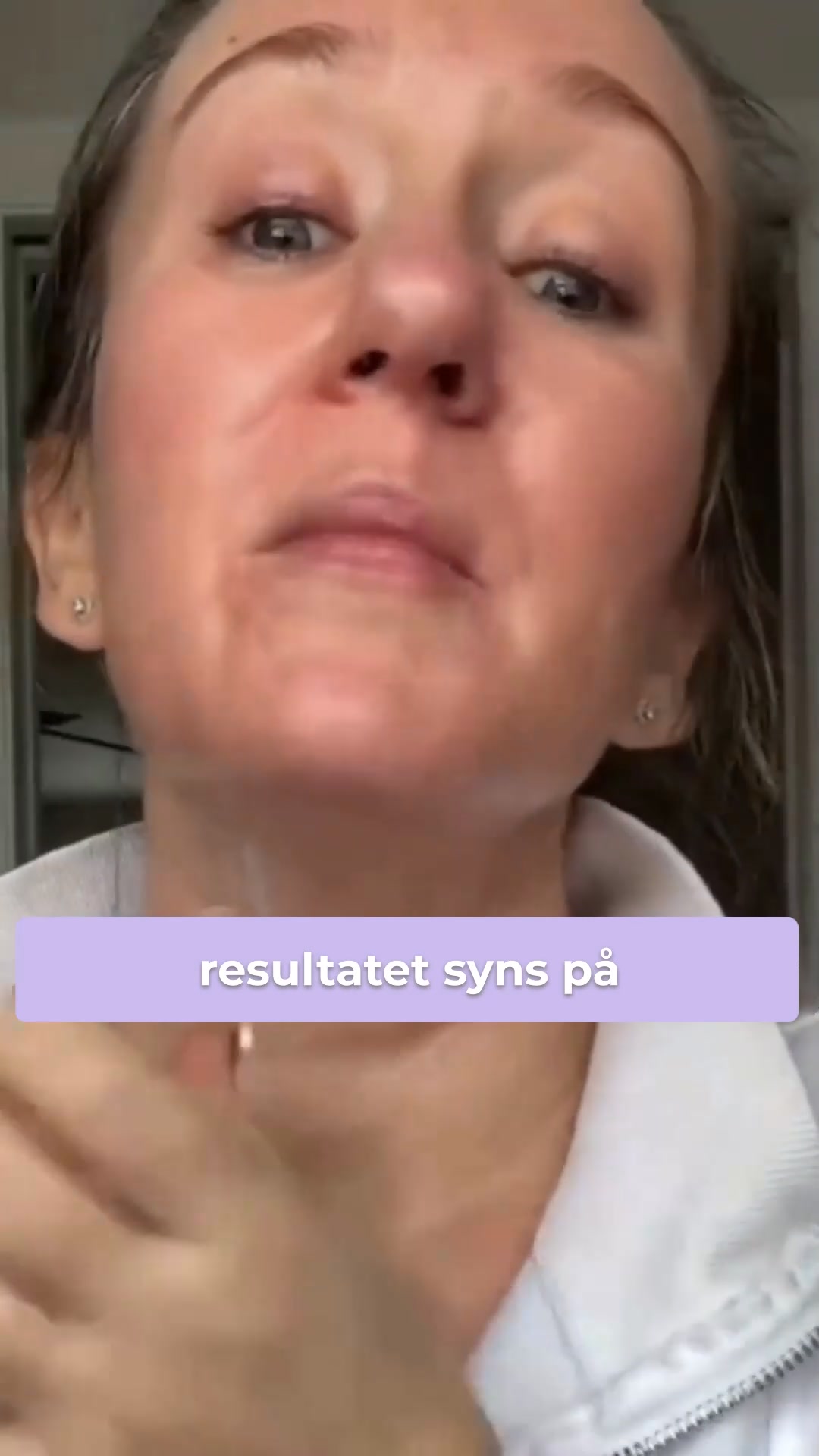 Fastare, Slätare Hud På Bara Några Veckor