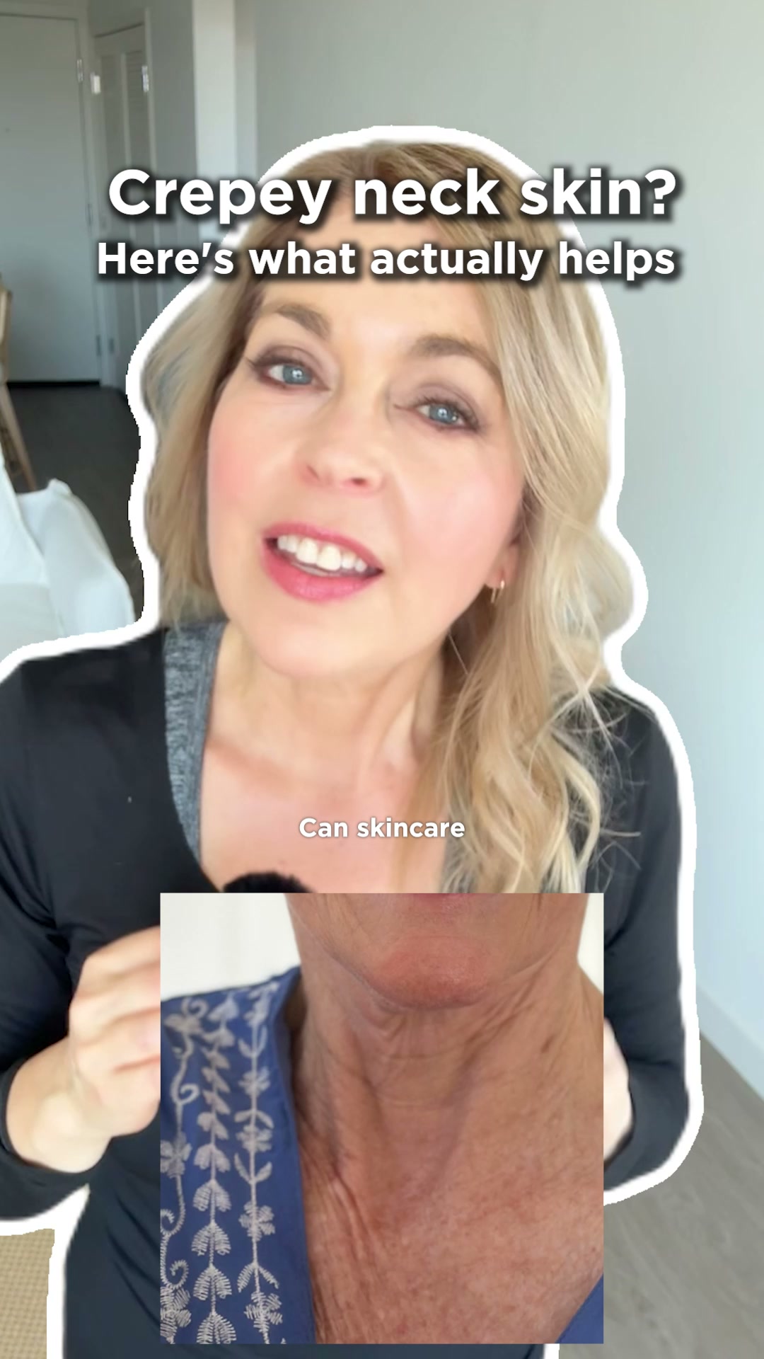 Crepey skin isn't a wrinkle problem