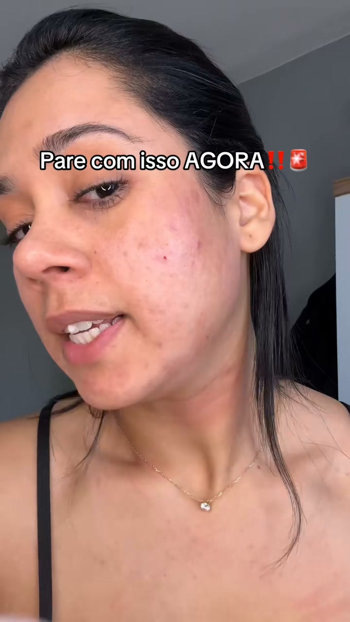 ESPINHAS E IMPUREZAS? EXPERIMENTA ISTO