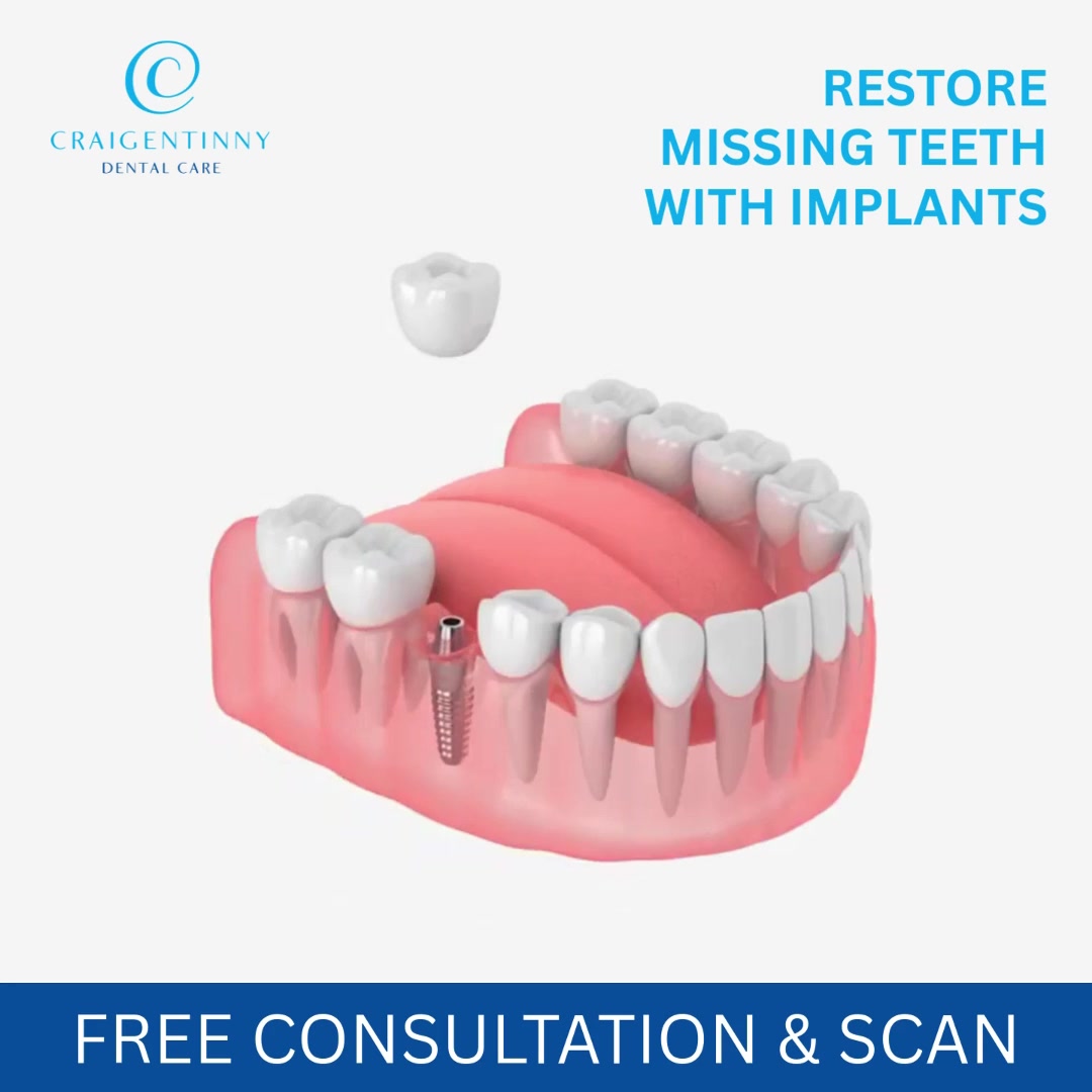 Restore Your Smile with Dental Implants