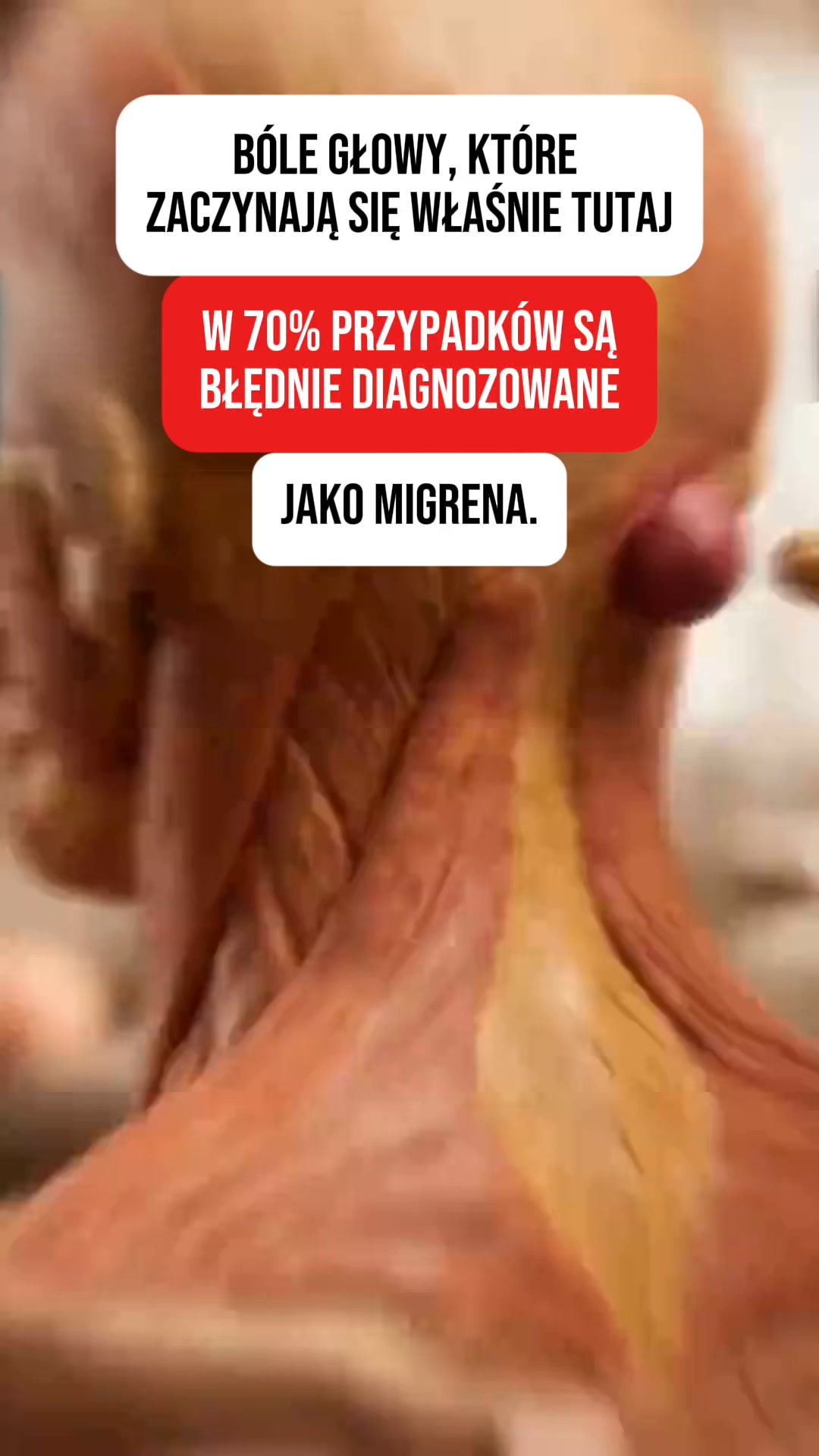 Koniec z bólem karku | 55 000+ zadowolonych użytkowników